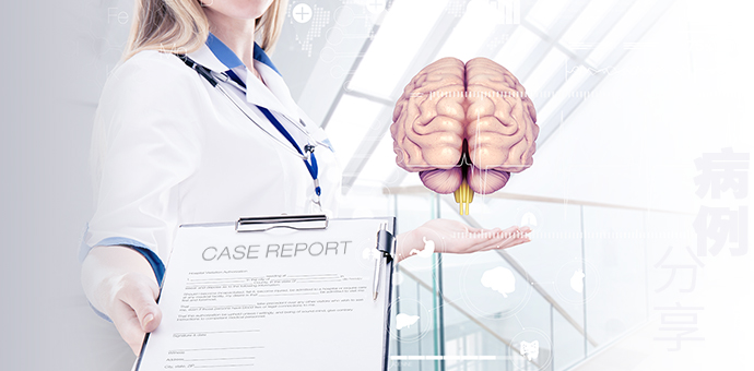  Misdiagnosis of Tentorial Dural Arteriovenous Fistulae: Two Cases Report